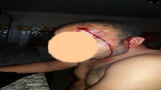 خطير جدا : من جديد نفس الشرطي يعتدي على صديقه داخل أحد الملاهي الليلية باكادير
