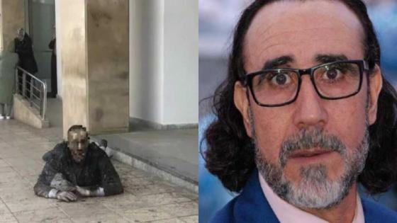 وفاة الفنان المسرحي أحمد جواد متأثرا بحروقه .