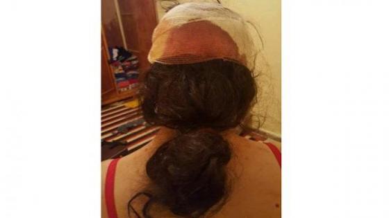 انزكان : زوج يشرمل زوجته في شهر العسل وخلية التكفل بالنساء ترفض استقبالها + الفيديو