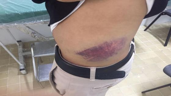 اطباء القطاع العام بسوس يحتجون على الاعتداء الشنيع الدي تعرض له طبيب بضواحي تزنيت